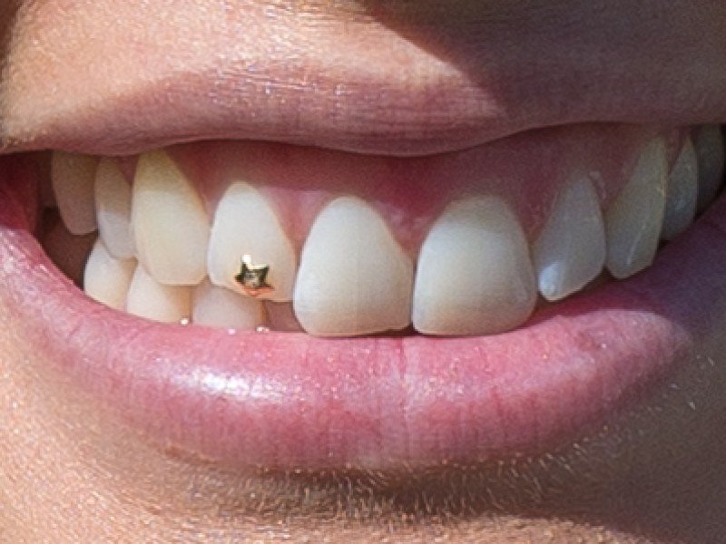 Dental Jewellery