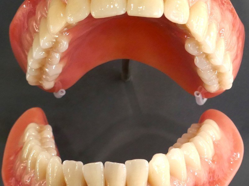 Construction Of Different Quality Material's Partial & Complete Dentures