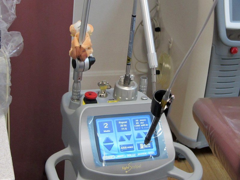 Dental Laser Surgery